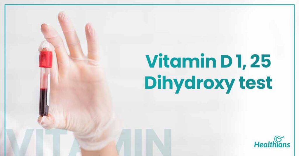 Please enjoy the great info Blood work vitamin d 25 hydroxy, Vitamin d 25 hydroxy, Vitamin d and 25 hydroxy test, Vitamin d 25 hydroxy test, Hydroxy vitamin d.