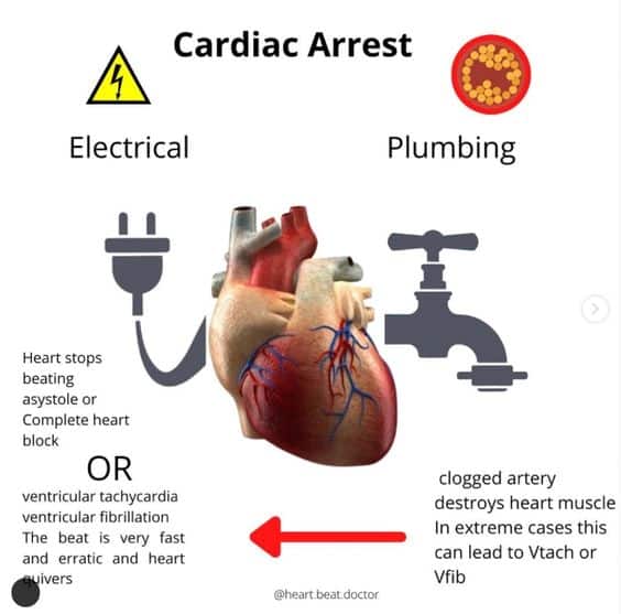 Enjoy the best information Cardiac arrest vs heart attack, Congestive heart failure, Cardiac arrest, Cardiac arrest symptoms, Heart failure.