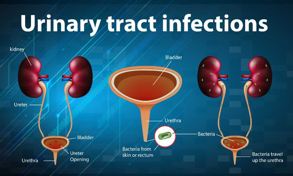 This blog more focus about Bladder pain syndrome, Bladder pain, Reproductive system, Bladder cancer treatment, Interstitial cystitis.