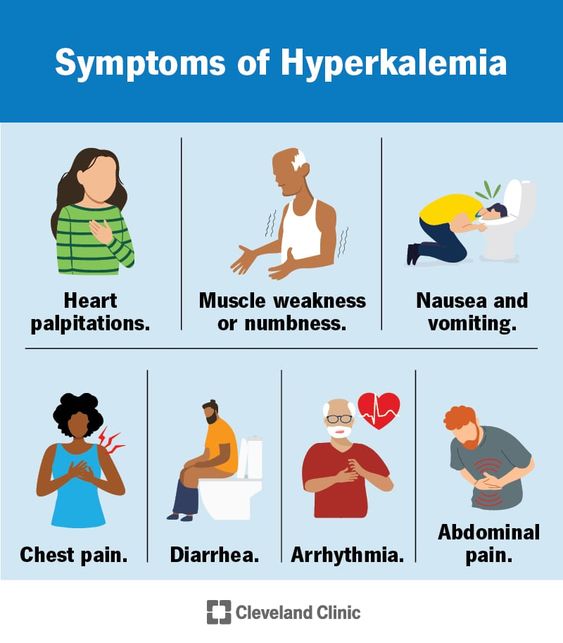 This blog more focus about hypocalcemia symptoms, hypocalcemia treatment, hypocalcemia causes, low calcium symptoms, hypocalcemia.
