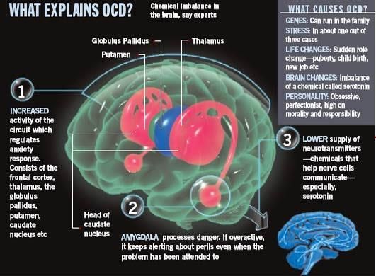 Enjoy the best information , how scan help for anxiety. Brain scans anxiety, Anxiety disorder brain scan, OCD brain scans, Reduce anxiety, Brain scan.