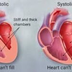 Diet for High Cholesterol: Best Foods to Eat.