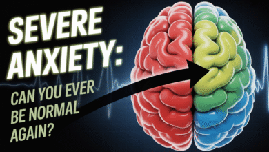 Severe Anxiety Symptoms