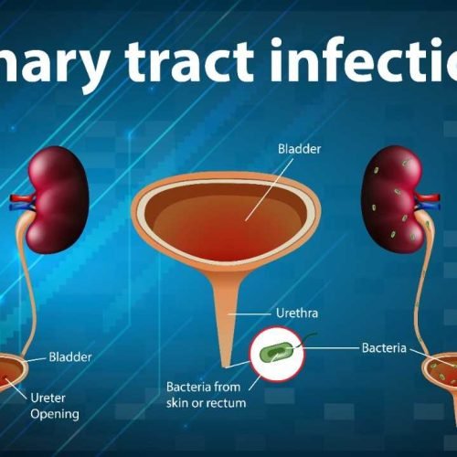 This blog more focus about Bladder pain syndrome, Bladder pain, Reproductive system, Bladder cancer treatment, Interstitial cystitis.