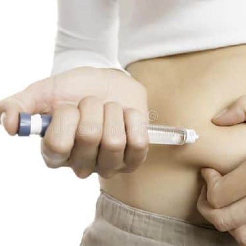 This Blog having great info about sliding scale insulin therapy, sliding scale insulin, intensive insulin therapy, insulin pump treatment, blood glucose levels.